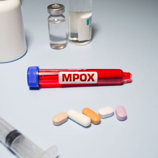 Child and two women among cluster infected with more serious strain of mpox in Ireland