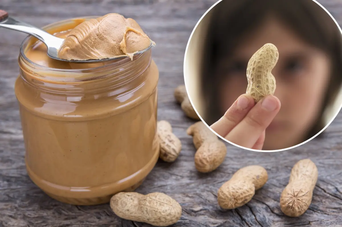 Parenting hack has prevented 60,000 kids from this allergy