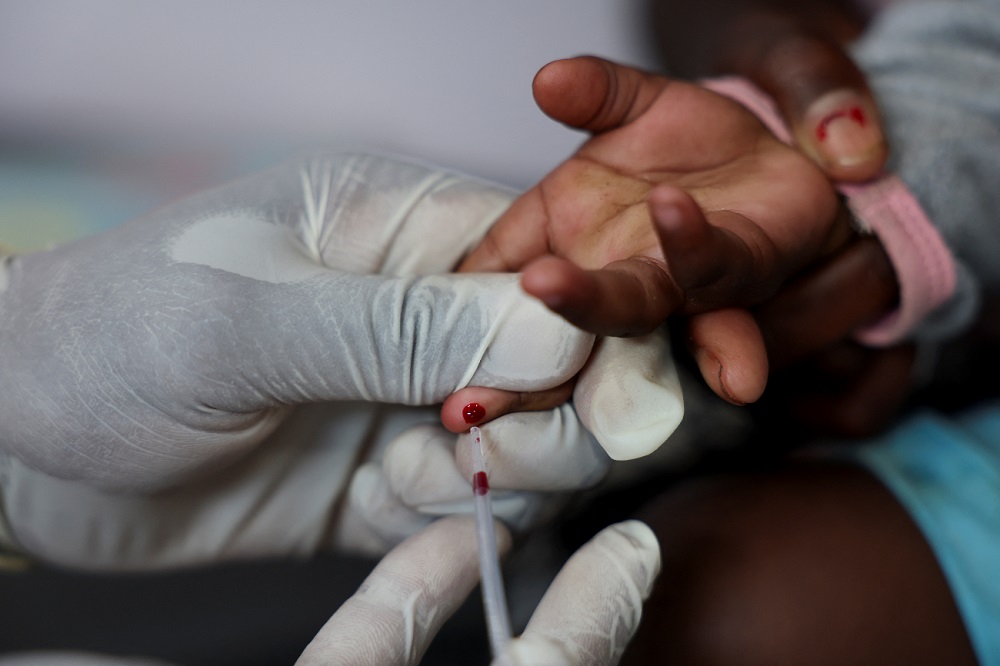 Unions report that nurse vacancy rate worsens in Limpopo hospitals