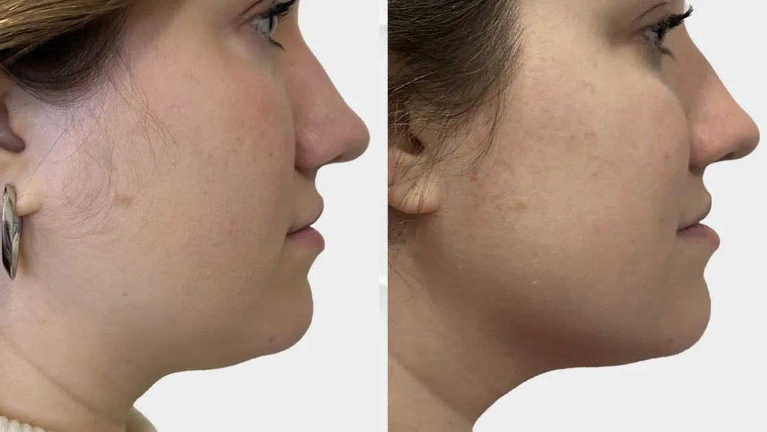 SickScience Labs ShapeShift Serum Works to Tighten the Neck