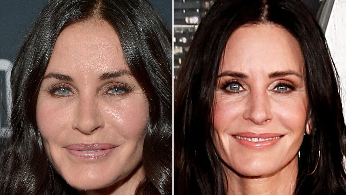 All the celebrities who have reversed their plastic surgery... as Alyssa Milano reveals why she is removing her breast implants