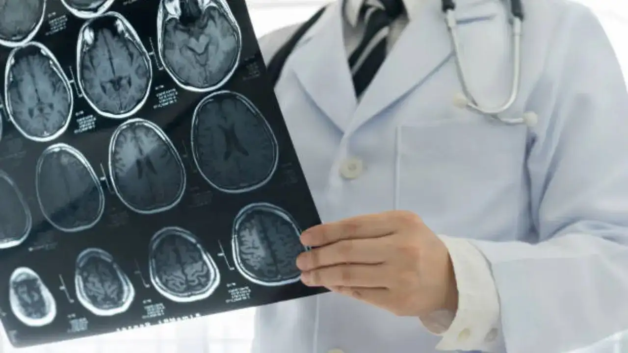 Simple Blood Test Can Predict Brain Diseases Years Before Symptoms, Says Neurologist