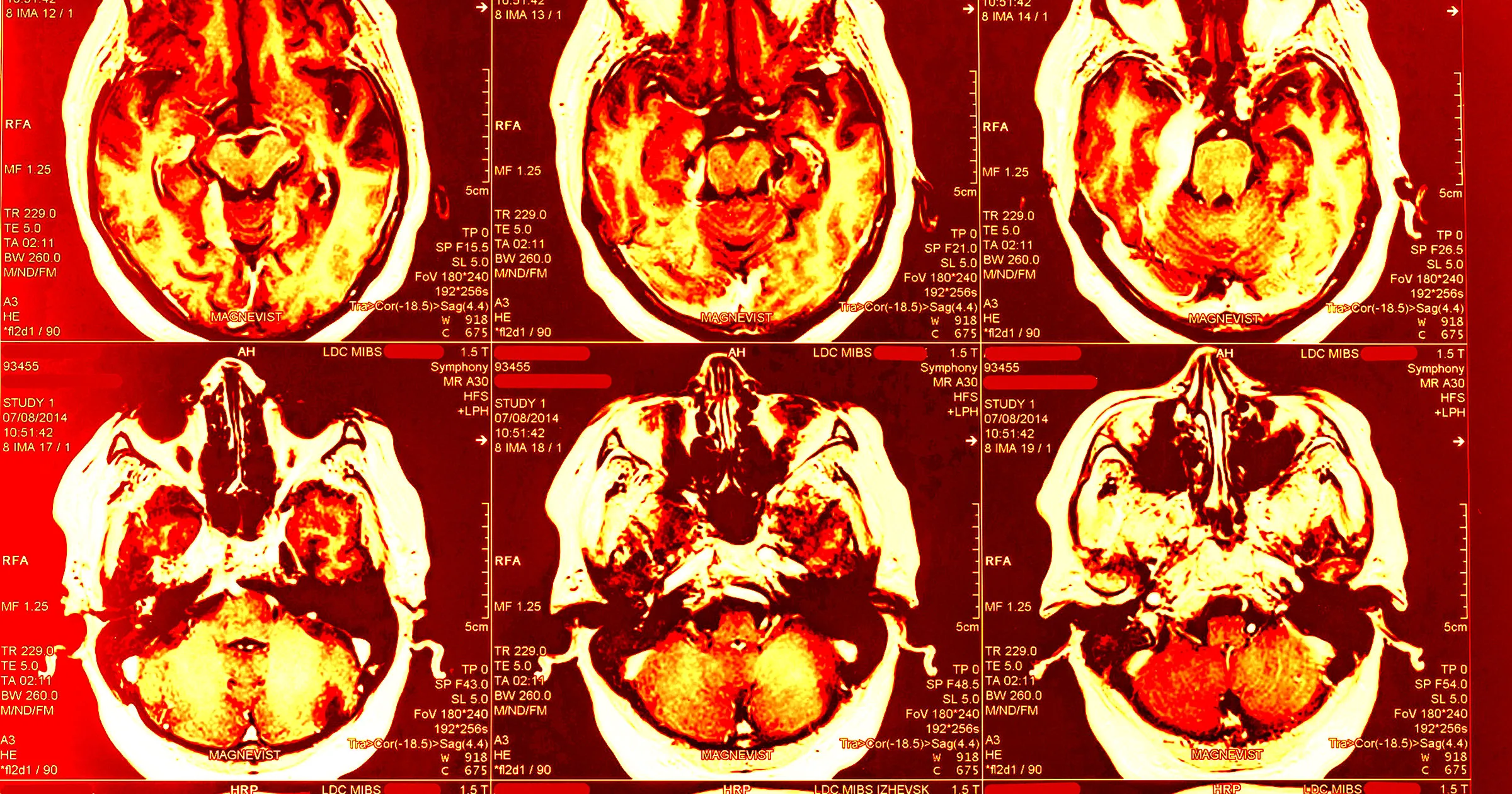 Medical Examiners Found Something Grim About the Brain of the Gunman Who Shot Up the NFL Building