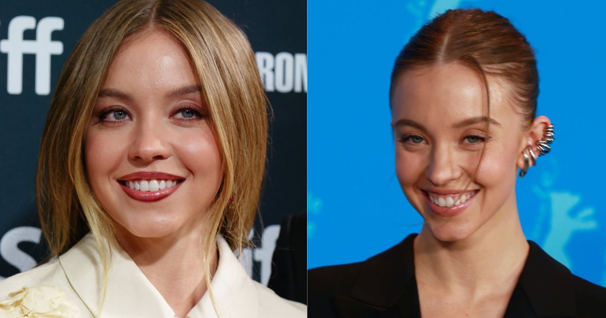 Is Sydney Sweeney Joining the Mar-A-Lago Face Trend? Plastic Surgeon Breaks It Down!