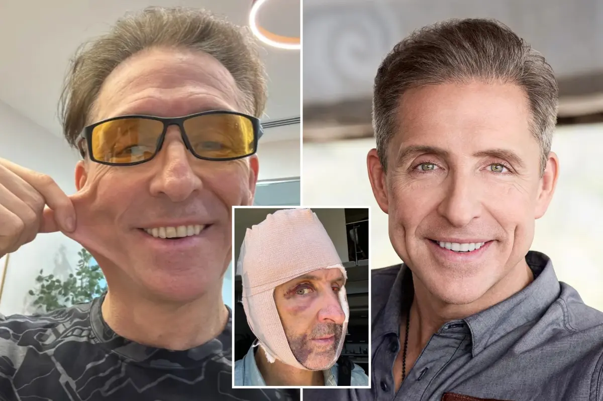How a ‘facial circumcision’ has made me look younger