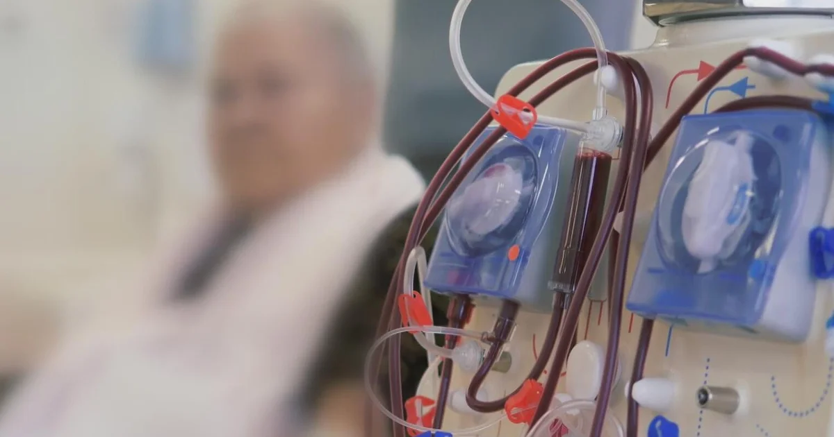 Death rates at U.S. dialysis clinics among the highest in the industrialized world