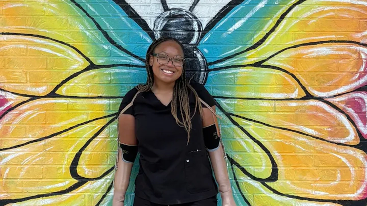 I’m a 25-year-old quadruple amputee - and I’m eager to get back to work: op-ed