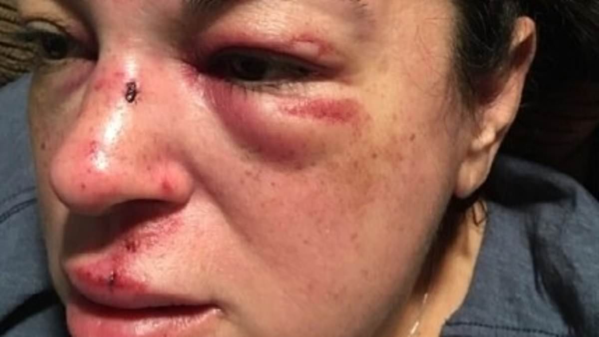 Female teacher awarded $7.5m by California city after she tripped over an uneven SIDEWALK