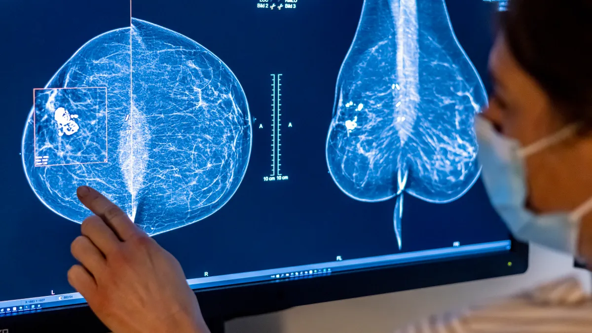 ‘Revolutionary’ AI-powered mammograms can predict breast cancer risk