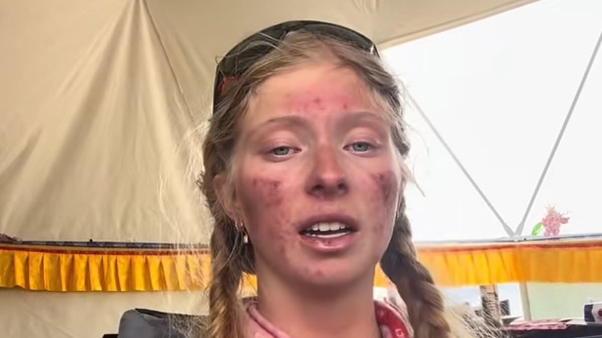 Aussie teenager, 17, reveals the brutal side-effects of climbing Mount Everest