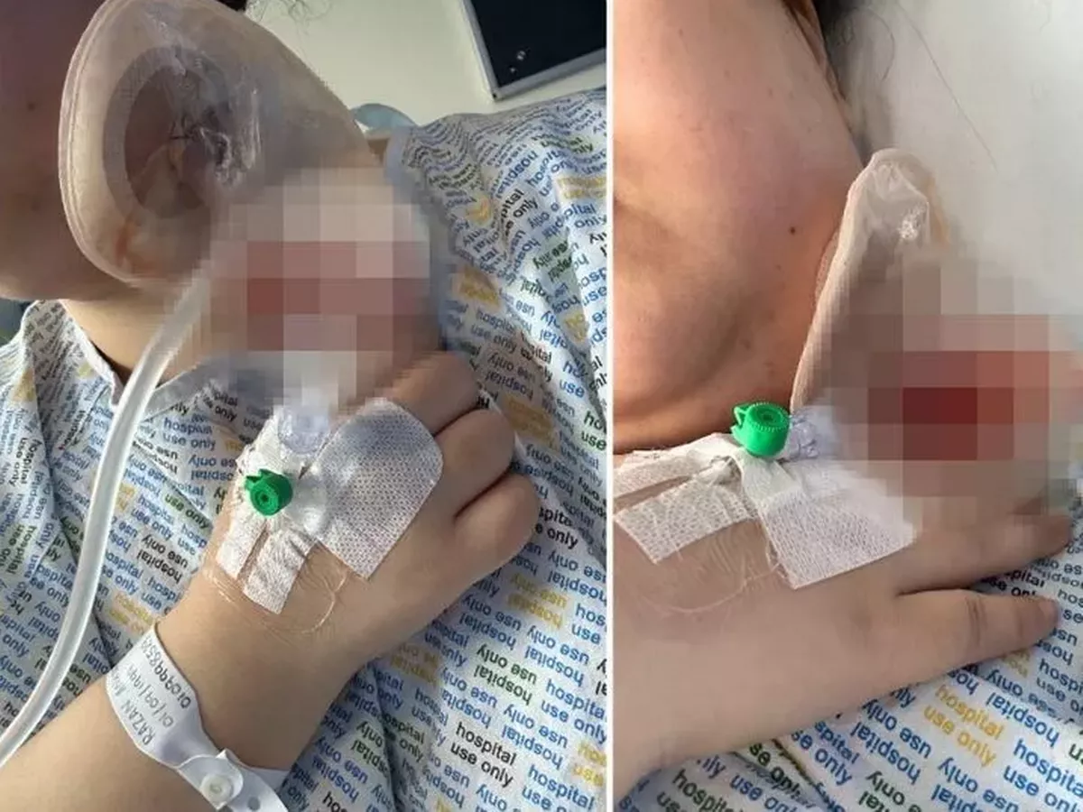 Scots woman left with 'knife wound' scar after dental procedure left her in 'unbearable pain'