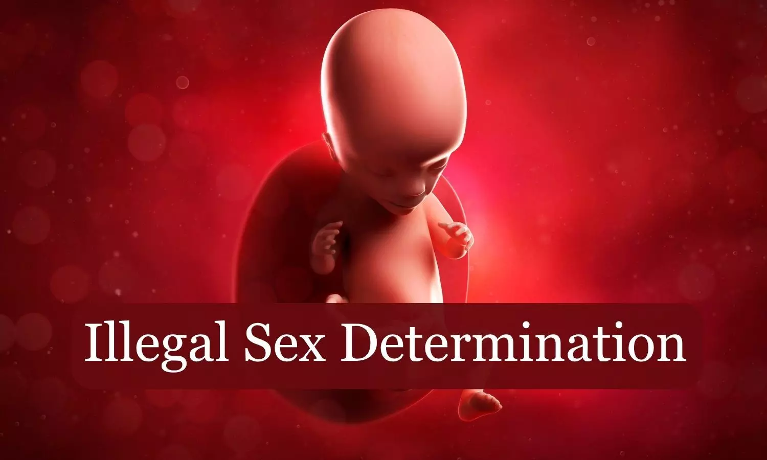 Illegal sex determination racket busted in Mysuru, 5 arrested