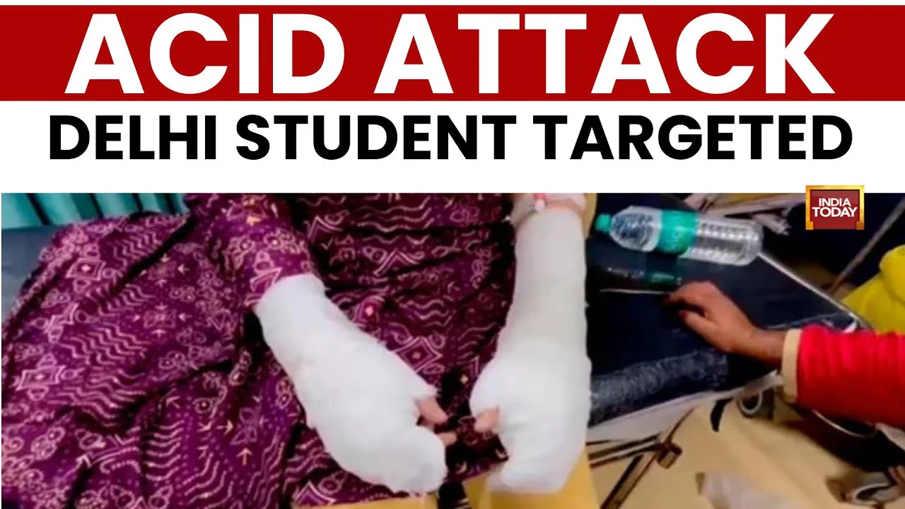Delhi Horror: Stalker, 2 others throw acid on DU student near her college