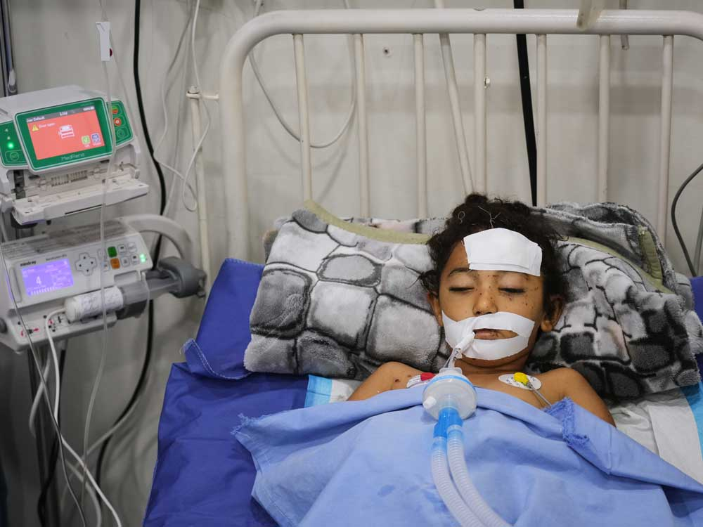 A bomb in Gaza’s rubble wounds twins who thought it was a toy