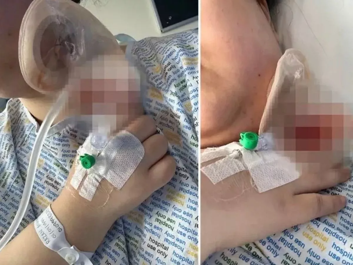 Woman left with 'knife wound' scar on neck after routine dental procedure