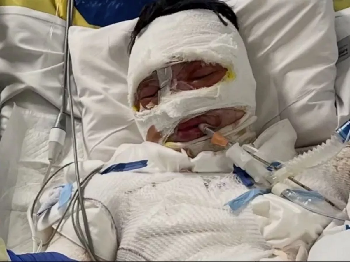 Teen 'doused in petrol and set alight' as part of 'ongoing feud' between families