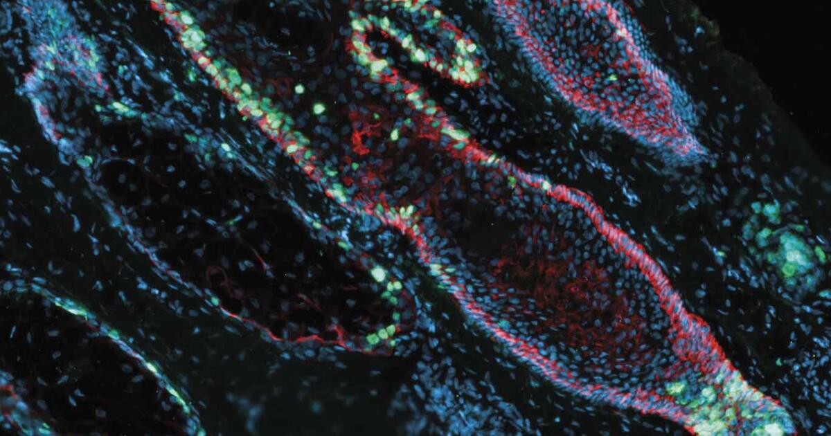 Pelage Pharmaceuticals Raises $120M Series B for Hair Loss Treatment