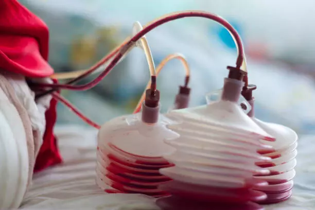 Oral TXA as effective and safe as IV TXA in hip and knee arthroplasty: study