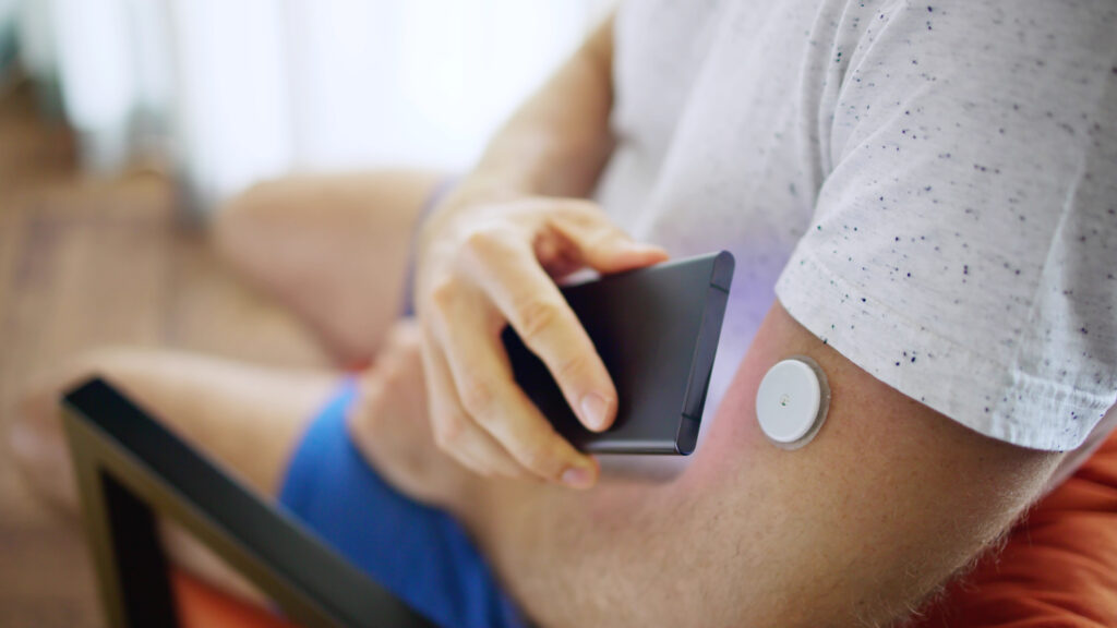 Diabetes prevention: Could AI be as good as humans?