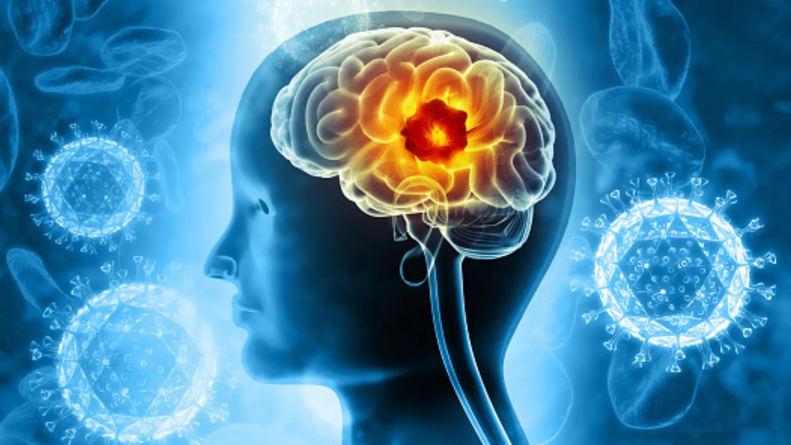 Micro-Strokes, Major Clues: Decoding The Earliest Brain Warnings Before A Full-Blown Stroke