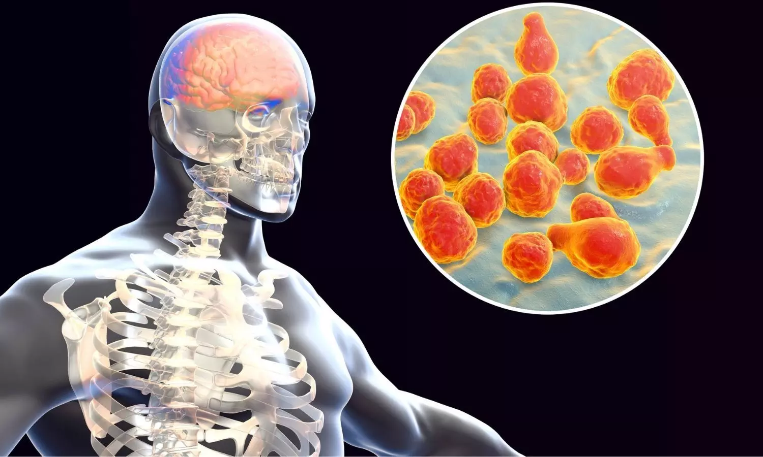 Kerala partners with ICMR-NIE to study rising Amoebic Meningoencephalitis cases