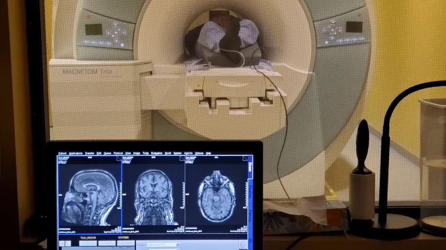 New study finds 40Hz sensory stimulation may benefit some Alzheimer’s patients for years