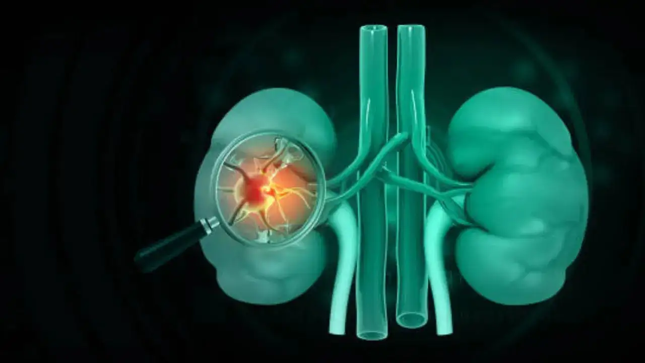 Strange Kidney Illness Strikes Hyderabad Residents: What’s Behind It?