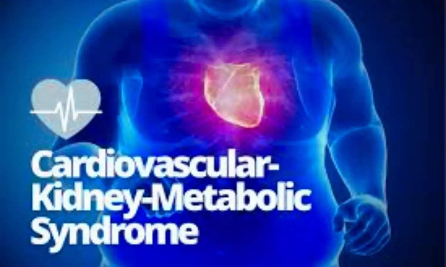 Childhood to Adulthood BMI Shift Linked to Midlife Cardiovascular, Kidney, and Metabolic Risks: Study