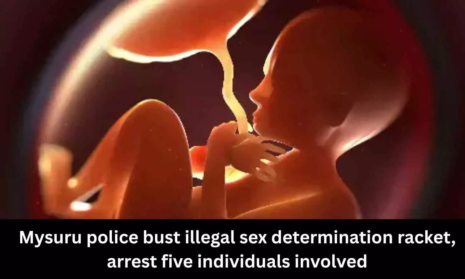 5 arrested in crackdown on illegal sex determination racket in Mysuru