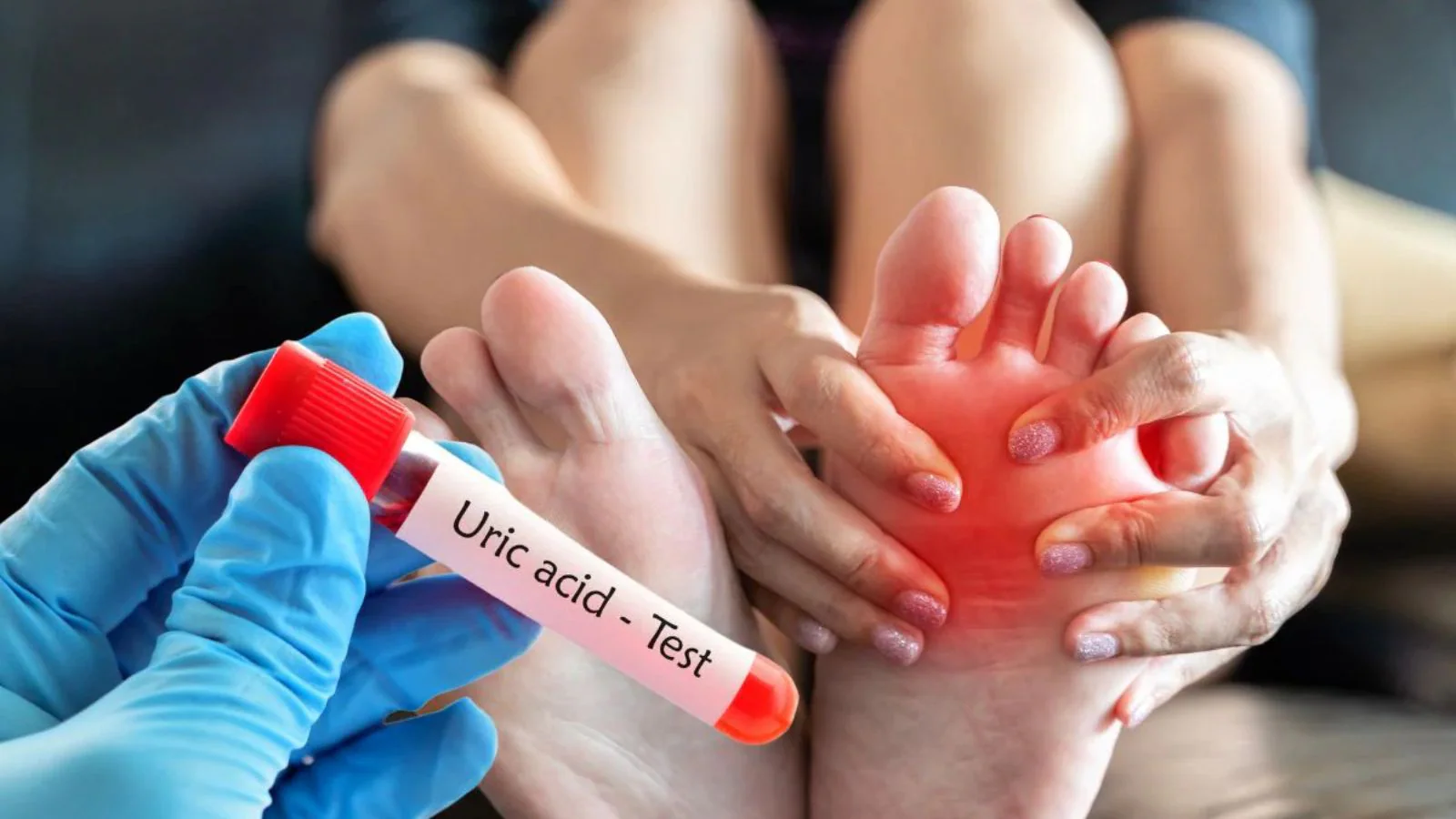 High Uric Acid? These Easy Home Tricks Could Be The Cure You're Ignoring