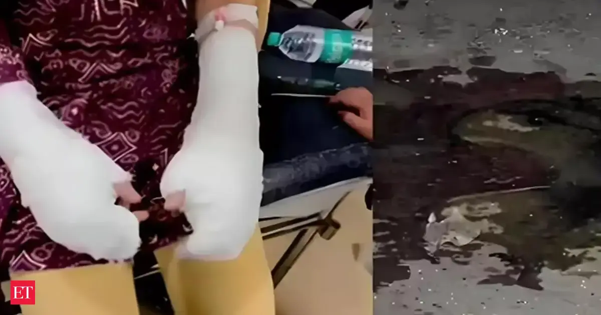 Twist in Delhi acid attack case: Police say dad poured chemical on girl to implicate others