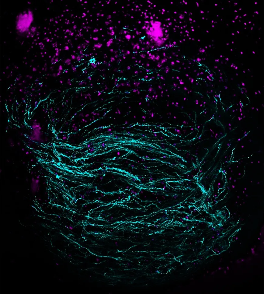 Scary movies and haunted houses: CU Boulder team studies how the brain responds to fear