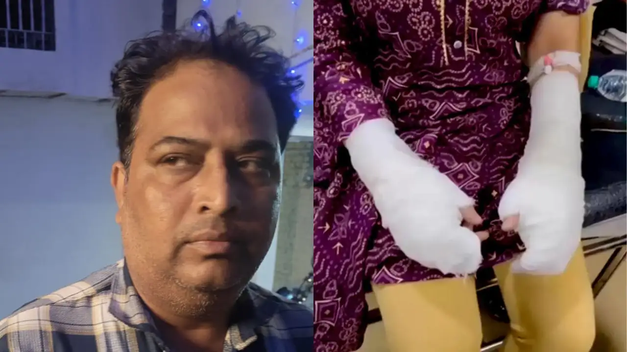 Twist in Delhi acid attack case: Victim faked assault; father booked for rape