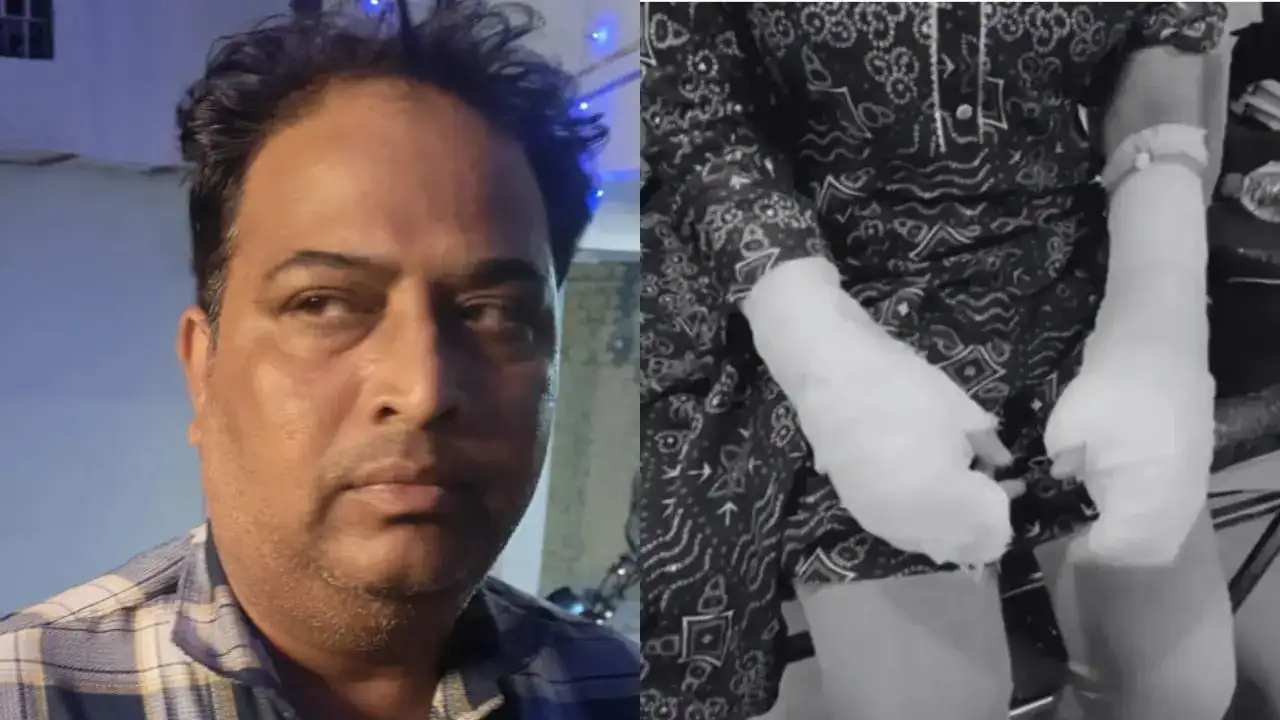 Delhi Acid Attack Twist: Girl’s Father Arrested For Fabricating Story, Rape Allegation by Wife of Alleged Attacker