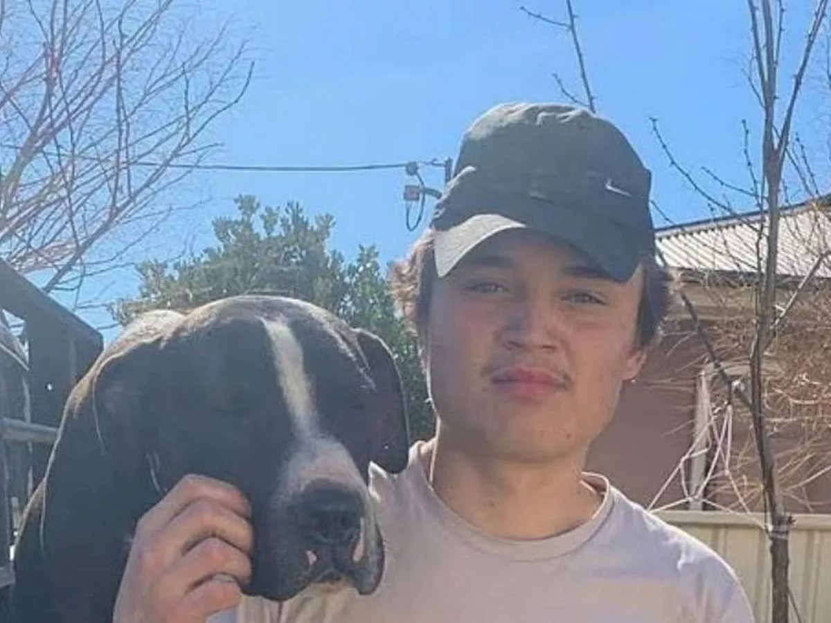 Teen 'doused in petrol and set alight' as family reveal gruesome extent of injuries