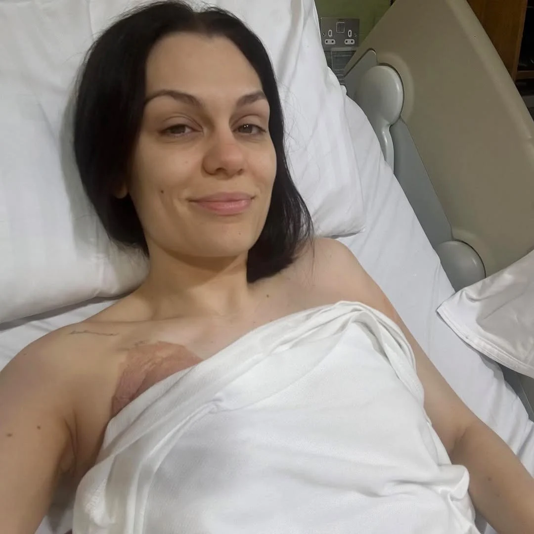 Jessie J says she's 'frustrated' after her second cancer surgery is postponed after rescheduling her tour