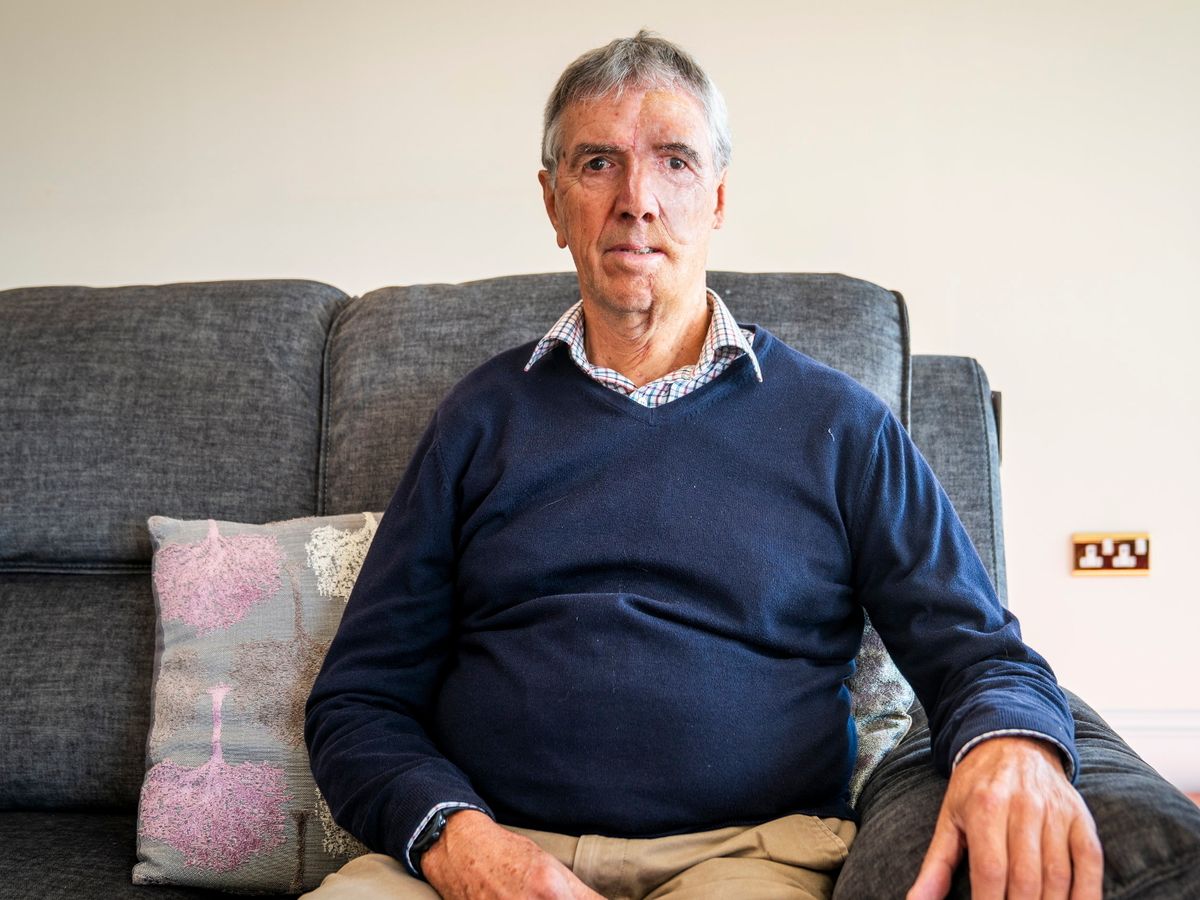 Crash victim gets first 3D printed face from new NHS body part printing centre