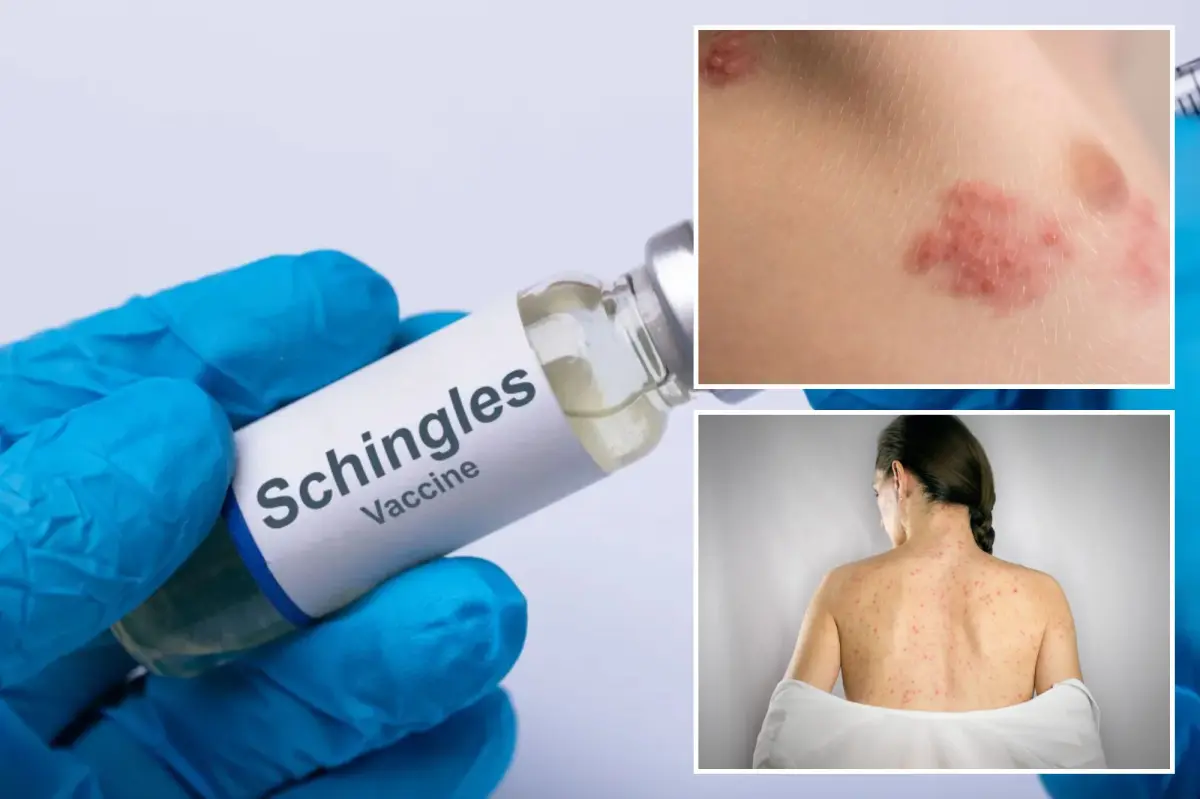 Shingles vaccine connected to significant health benefits, experts reveal