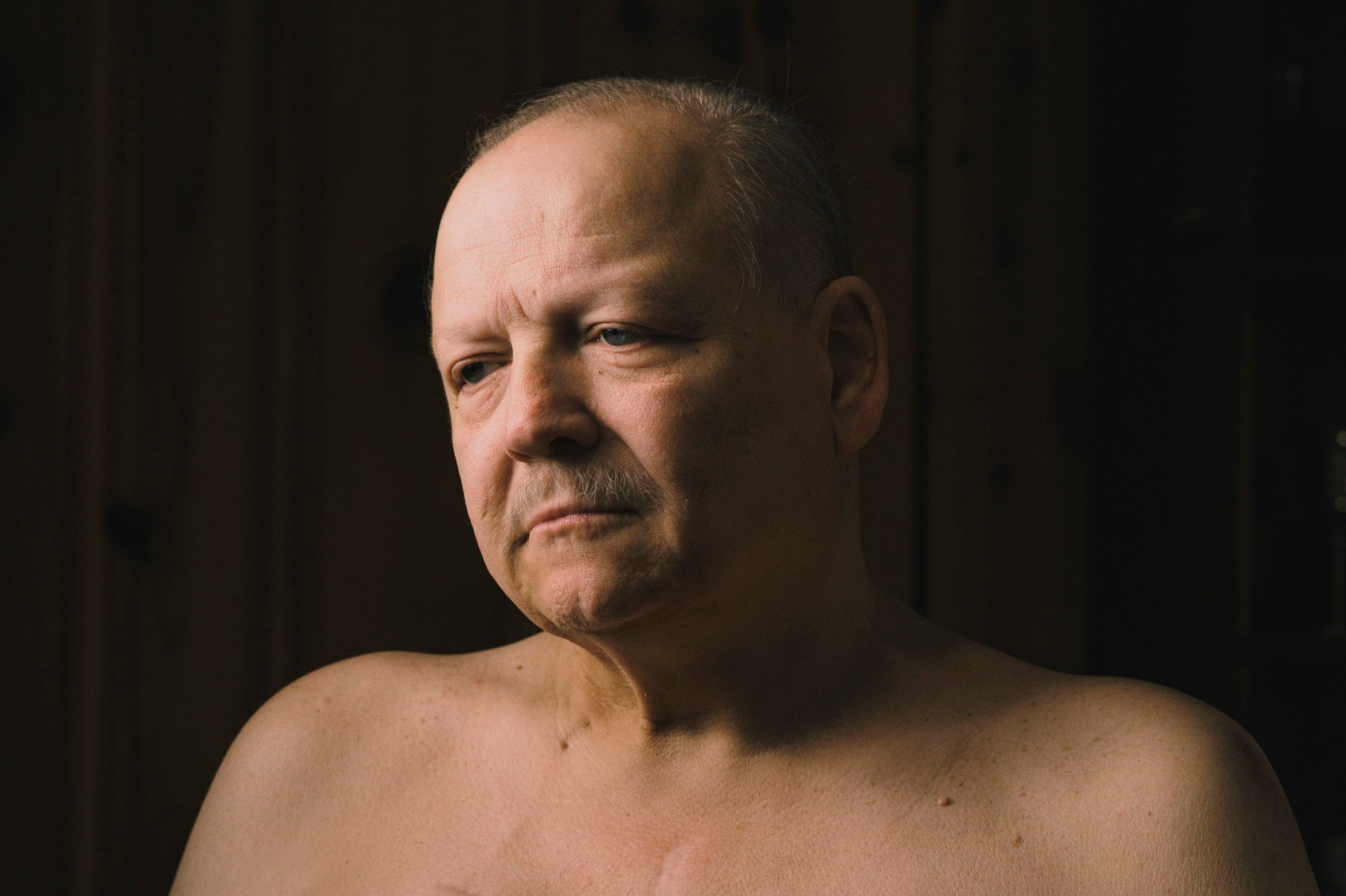 VA Makes It Harder for Male Veterans With Breast Cancer to Get Coverage