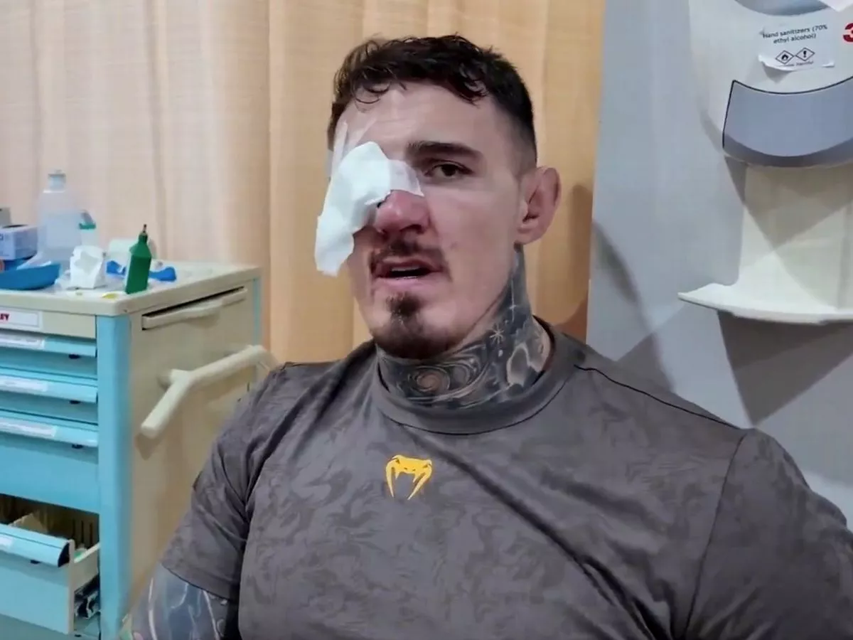 Tom Aspinall shares footage of eye injury as doctor issues update