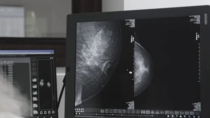 Metro Detroit breast cancer survivor shares journey, urges women to get annual mammograms