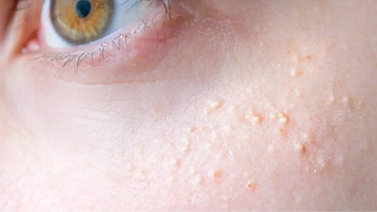 Reason behind series of white spots on your body and private parts as experts issue serious warning