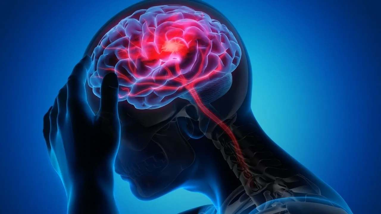 World Stroke Day: Reminding urgency in recognising, preventing life-threatening condition