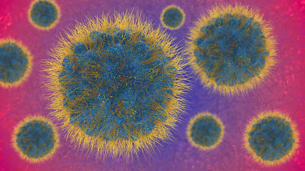 Why new mpox cases in California are raising concerns