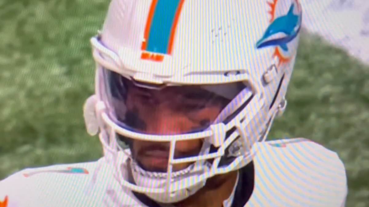 Tua Tagovailoa's swollen eye sparks concern after Dolphins QB woke up with mystery illness on day of Falcons game