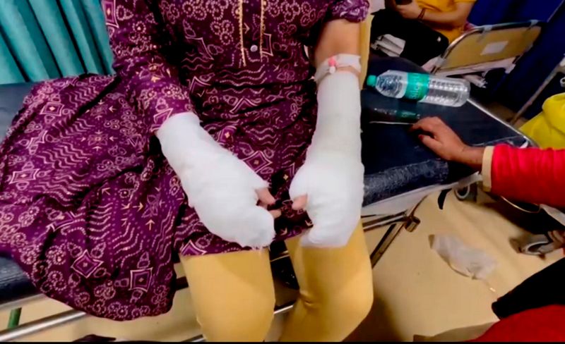 Twist in Delhi ‘acid attack’ case: Victim’s father arrested for fabricating assault story