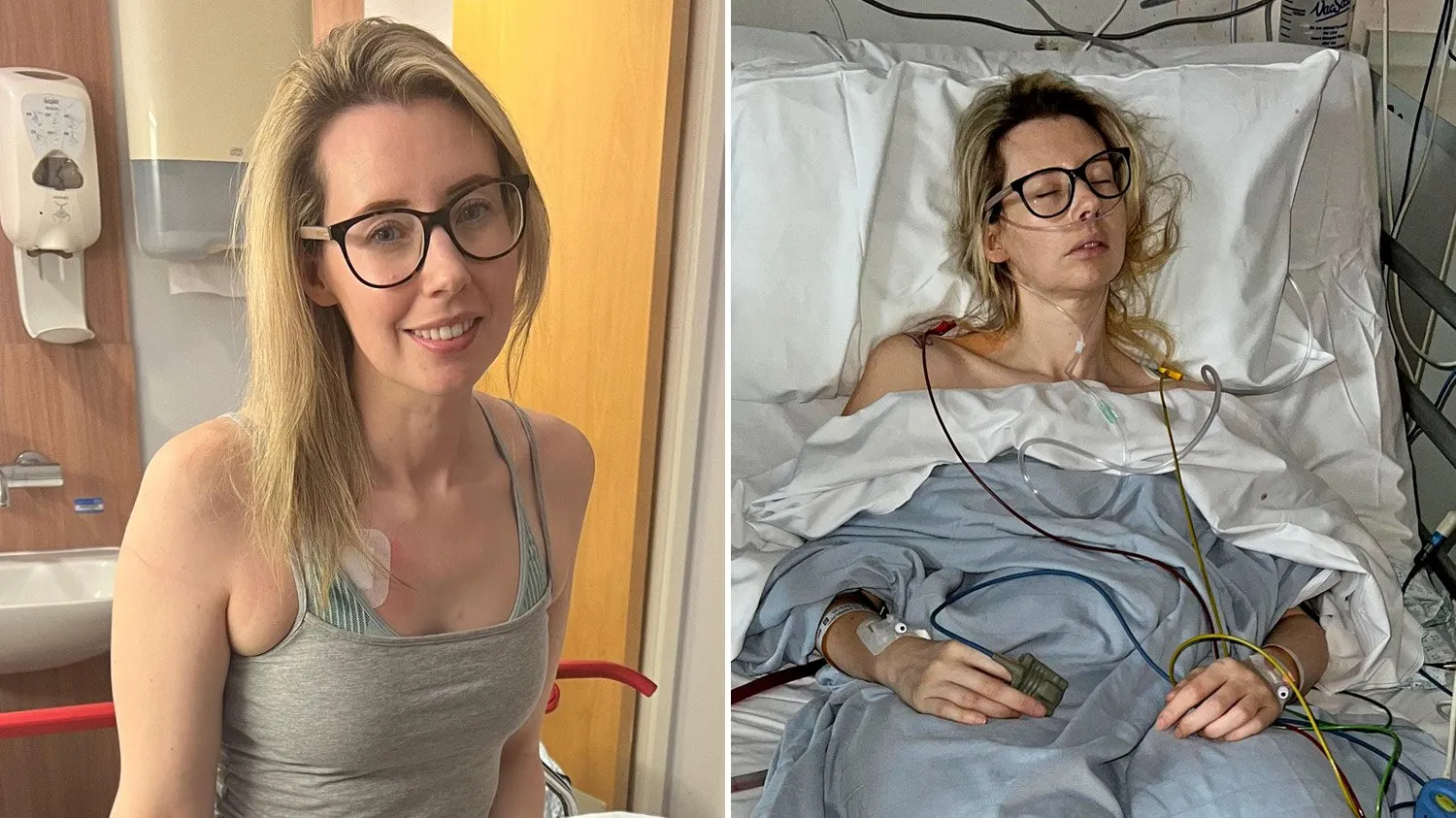 I thought I’d hurt myself at the gym — but I’ve got endometriosis in my chest