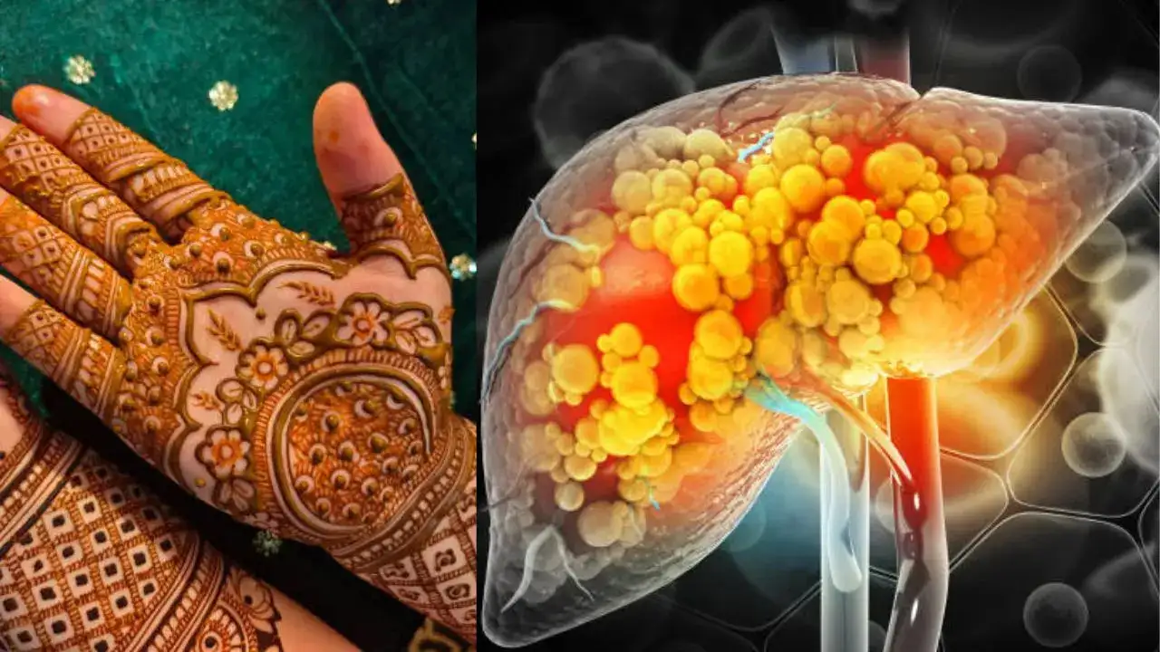 Henna Dye Can Treat Liver Disease, Study Finds