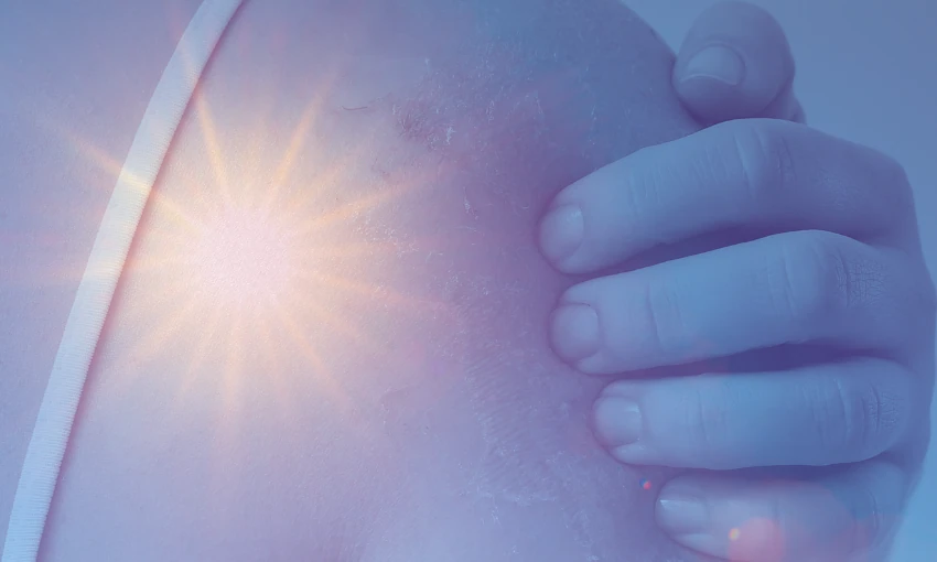 The sun, a scab – and stage 3 melanoma