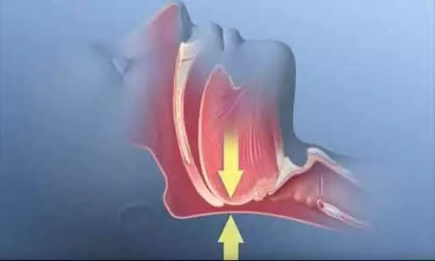 Eye Scan May Help Detect and Predict Severity of Sleep Apnea, Study Finds